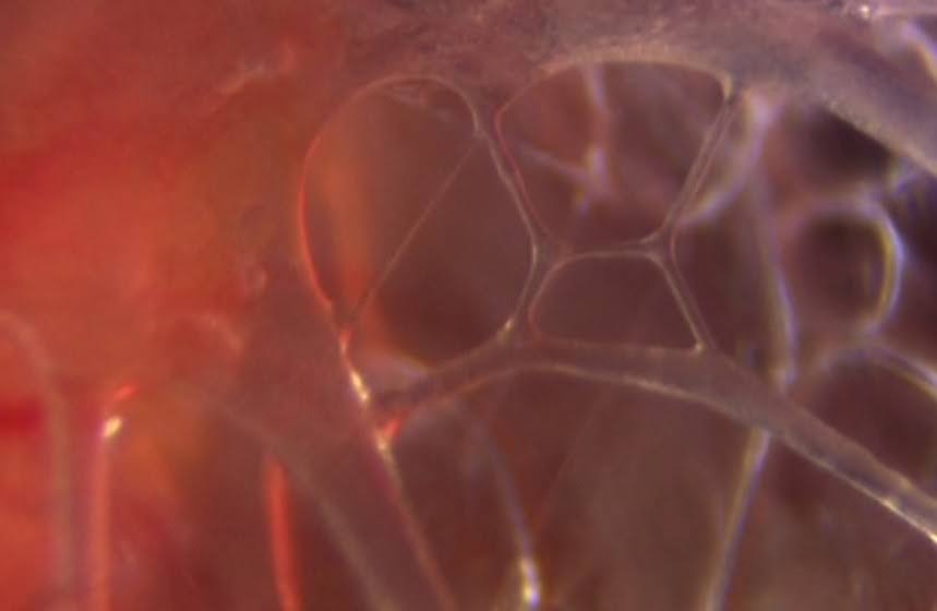 Photo de fascia sous endoscopie