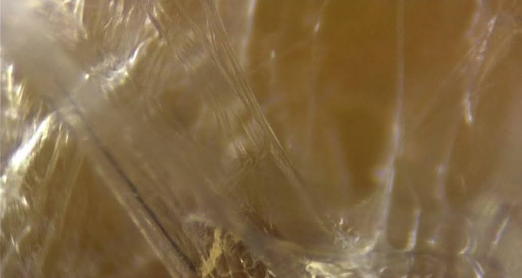 Photo de fascia sous endoscopie