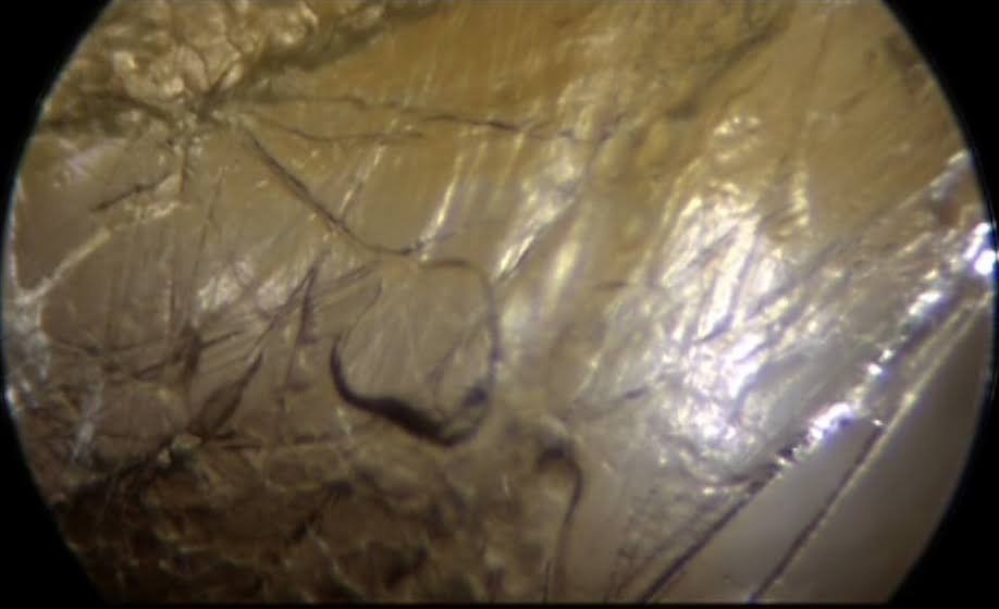 Photo de fascia sous endoscopie